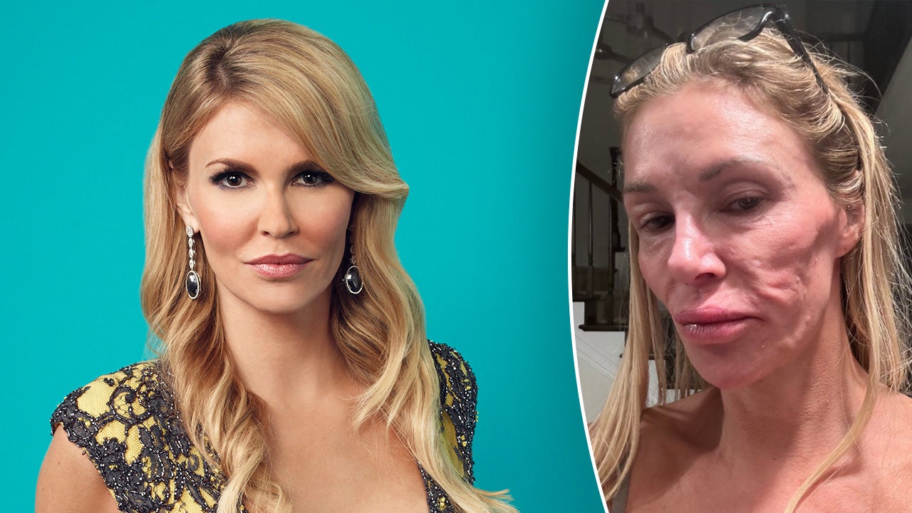 brandi-glanville-mystery-illness