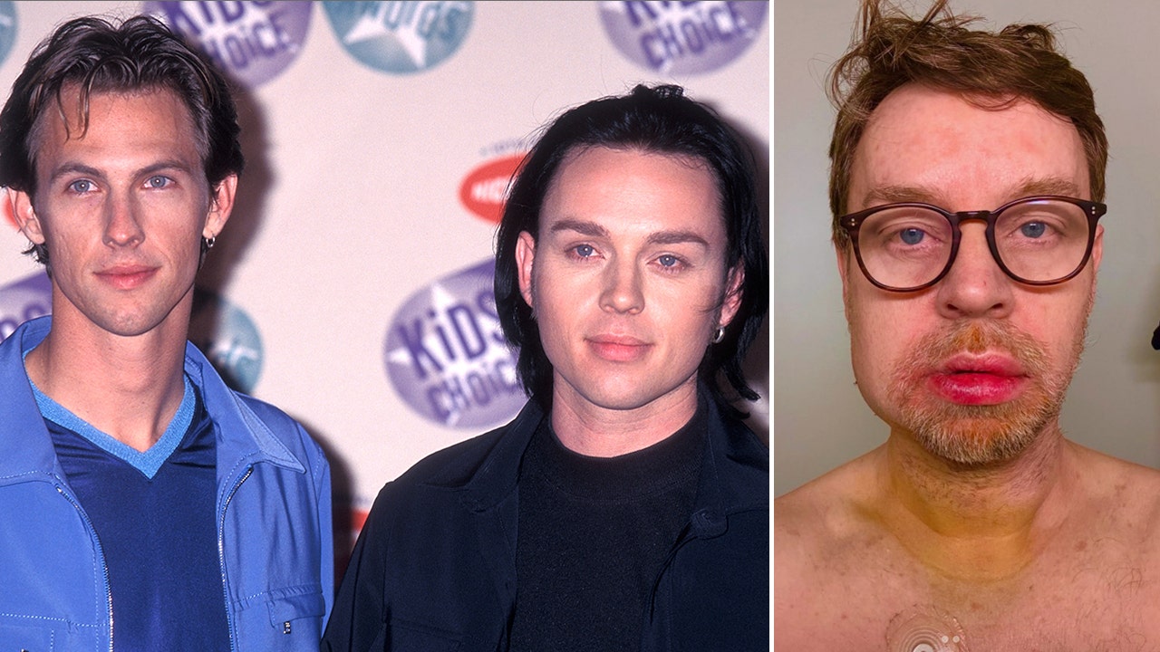 savage-garden-singer-accident